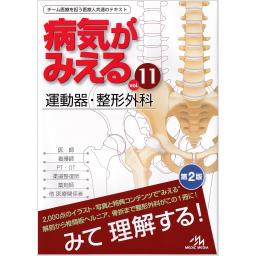 病気がみえる　Vol.11　運動器・整形外科　第2版