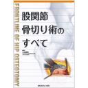 股関節骨切り術のすべて