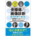 骨腫瘍の画像診断 疑う目を養う・鍛える