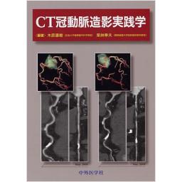 CT冠動脈造影実践学