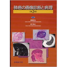 肺癌の画像診断と病理　第2版