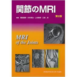 関節のMRI　第2版