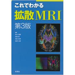 これでわかる拡散MRI　第3版