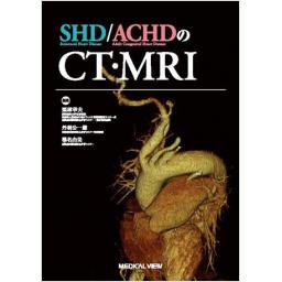 SHD/ACHDのCT・MRI