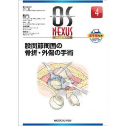 OS NEXUS　No.4　股関節周囲の骨折・外傷の手術