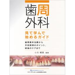 歯周外科　見て学んで始めるガイド