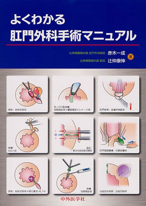 京都科学 肛門 痔 痔瘻 立体模型 標本 クリニック 診療所 - 救急/衛生用品