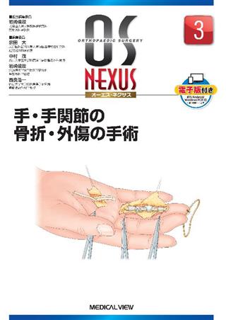 手・手関節の骨折・外傷の手術 (OS NEXUS ( ) 3)-