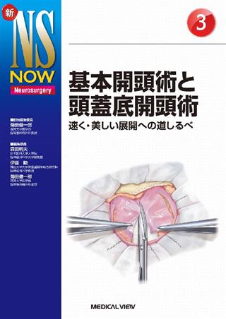 入門 頭蓋底手術 側頭骨アプローチのための解剖と手術の実際