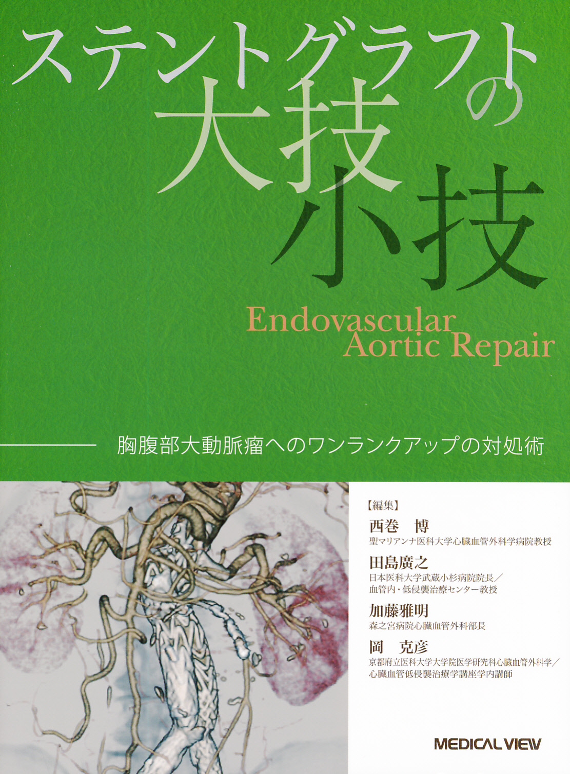 ステントグラフトの大技・小技−胸腹部大動脈瘤へのワンランクアップの