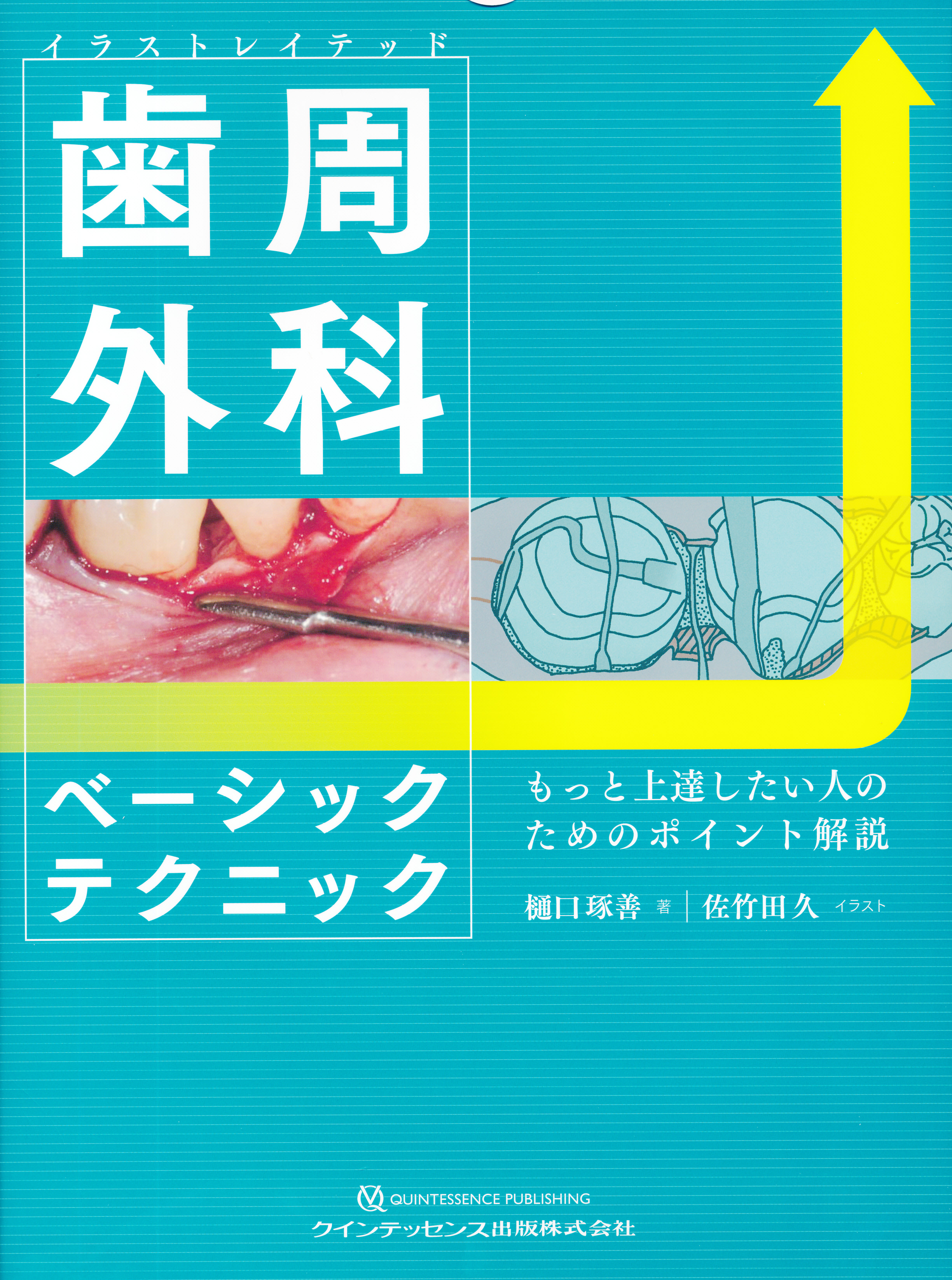 イラストで見る筒井昌秀の臨床テクニック／筒井昌秀(著者)，佐竹田久