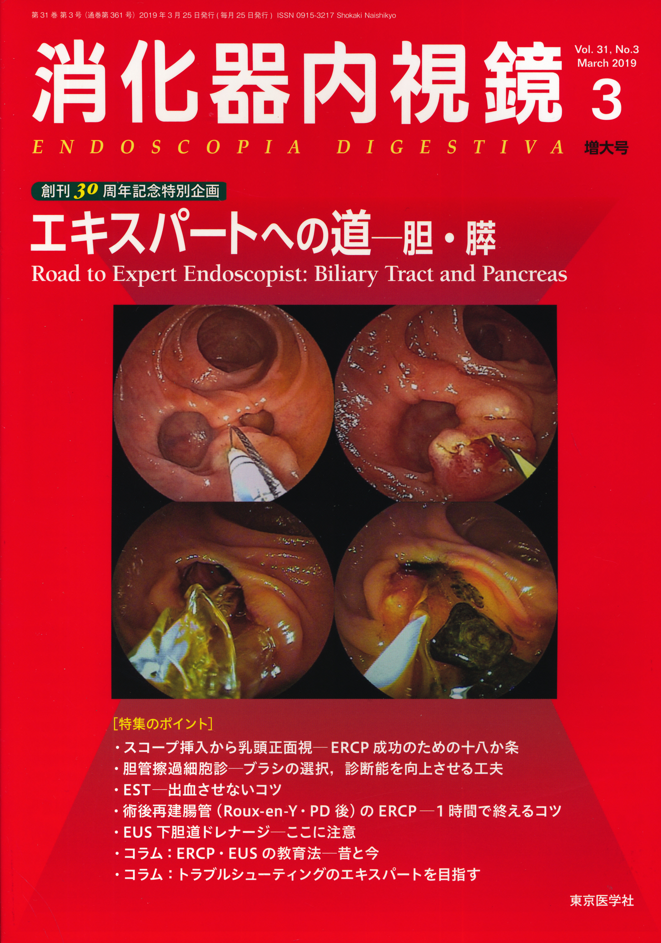 胆膵EUS教本?コンベックスEUSを極める - 臨床医学