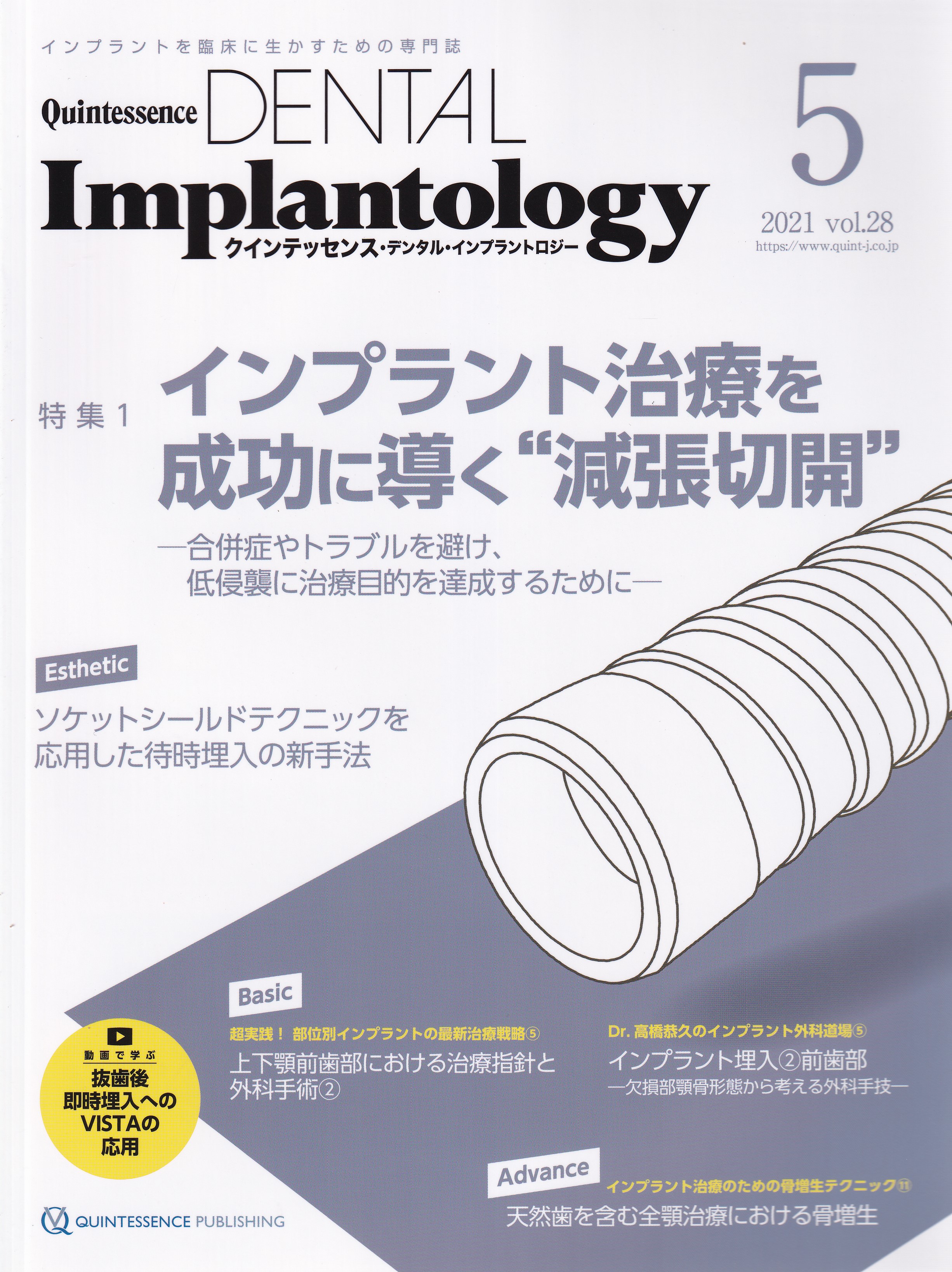 インプラントを臨床に生かすための専門誌 DENTAL Implantology 新作 