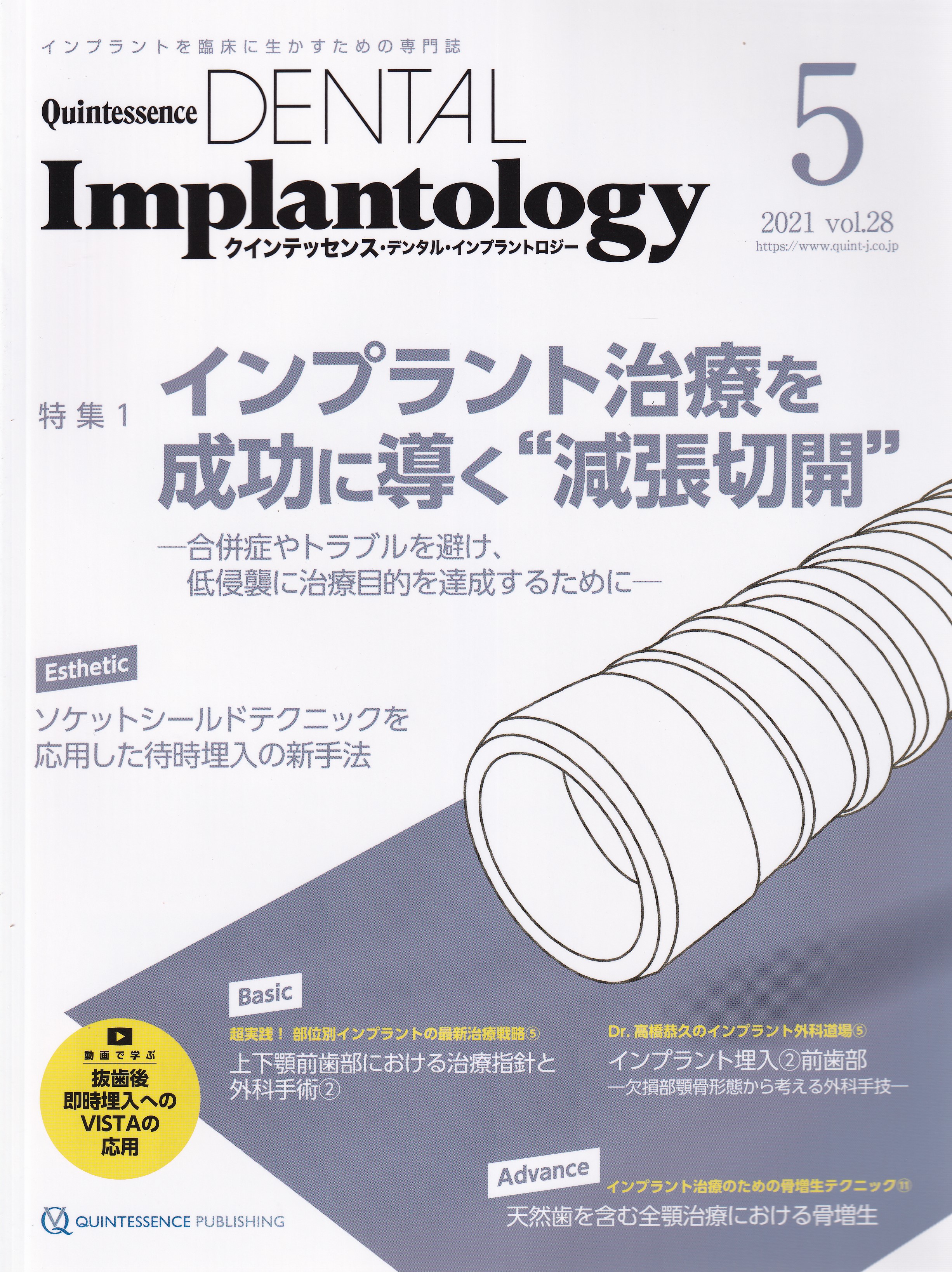 入れ歯クインテッセンス デンタル インプラントロジー 2021年 5冊