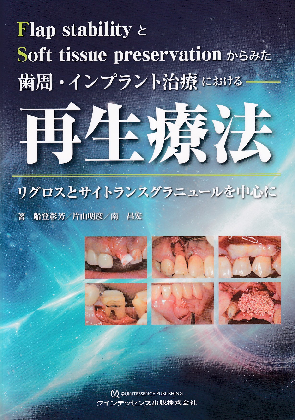 インプラント・歯周再建治療のティッシュマネージメント [新品] - 健康