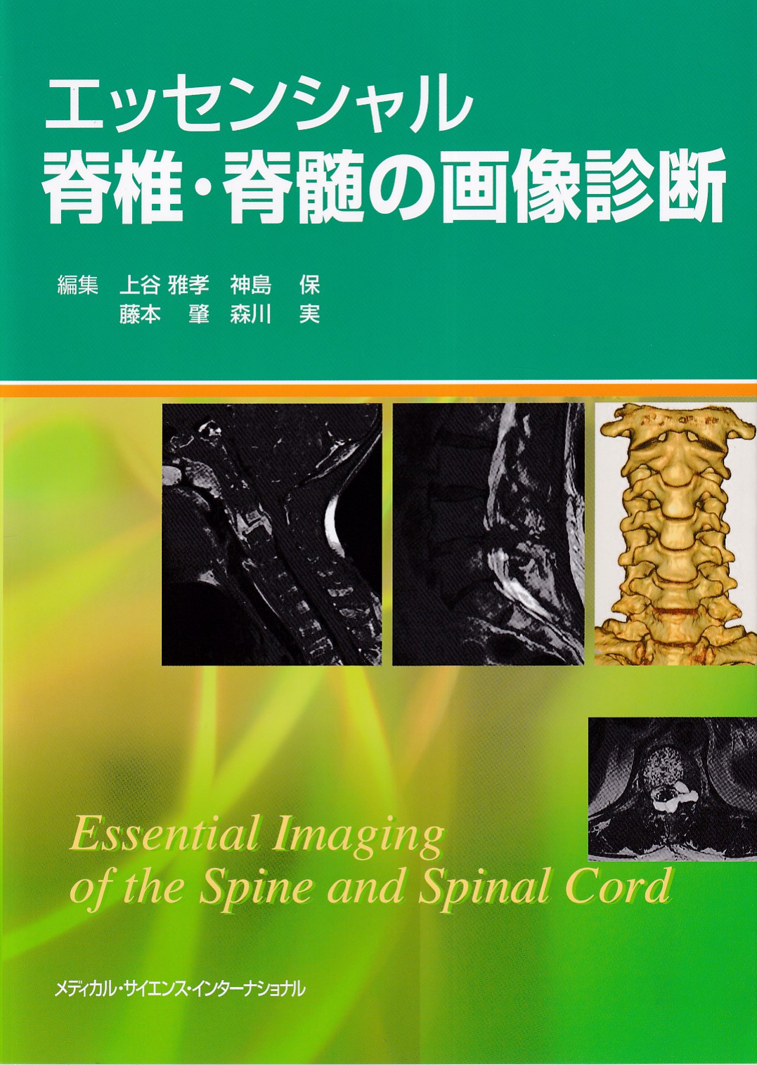 画像でみる脊椎・脊髄 その基礎と臨床 (新品) - 健康/医学