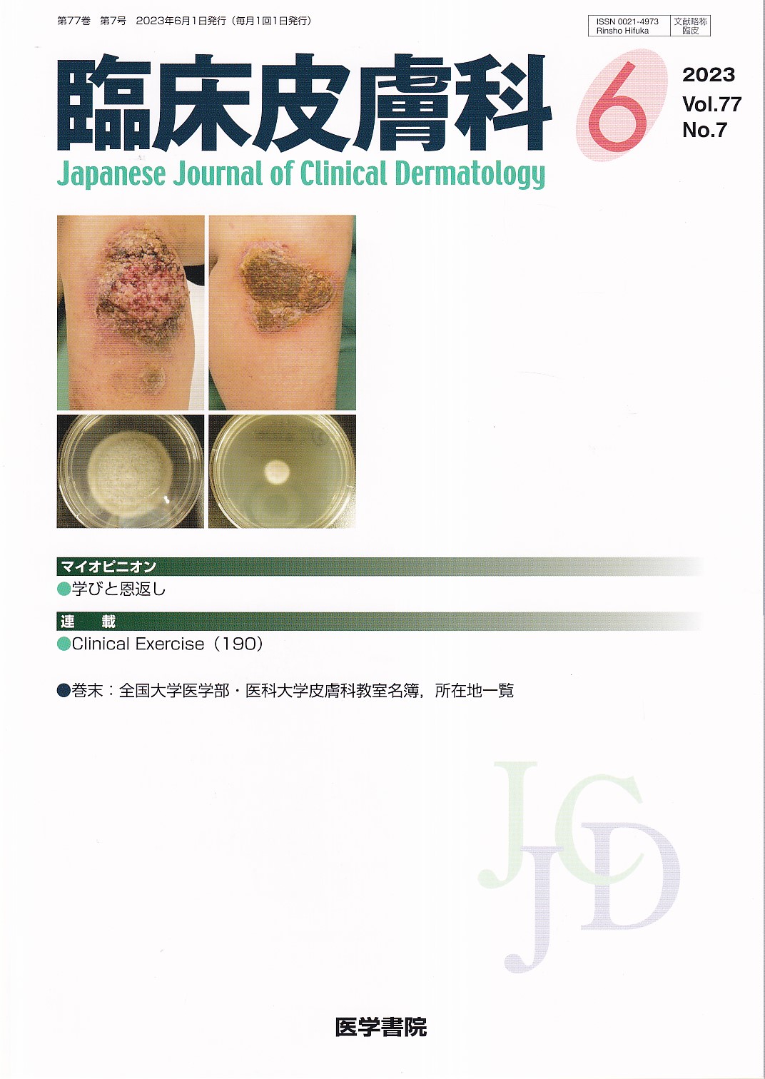 臨床皮膚科 2023年7月号